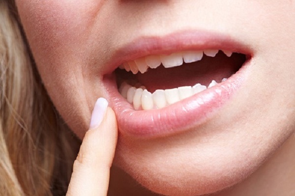 Răng hàm lung lay: Nguyên nhân và cách điều trị hiệu quả